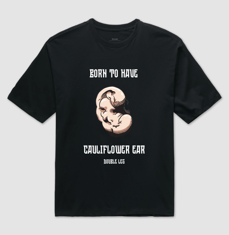 Born to have a cauliflower ear
