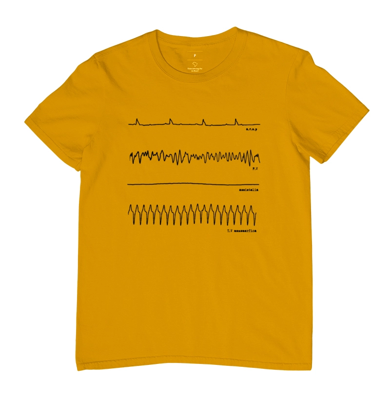 ECG
