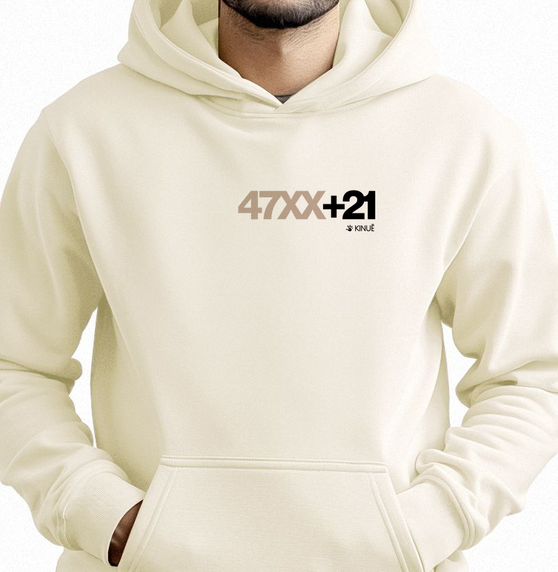 47XX+21 - Representação de exame cariótipo Síndrome de Down