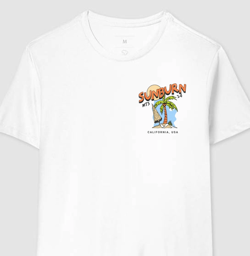 Sunburn