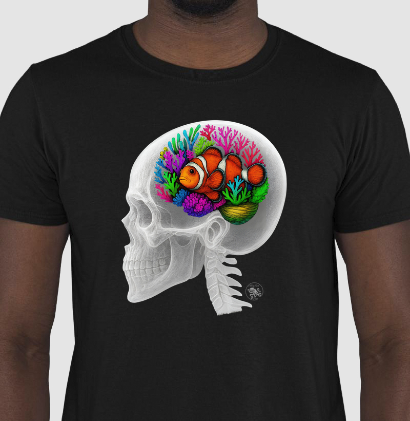 X-ray head